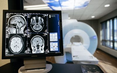 Brain Tumor Symptoms and Treatments