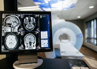 Brain scans on a screen at Sierra Neurosurgery Siemens MRI imaging center Reno NV