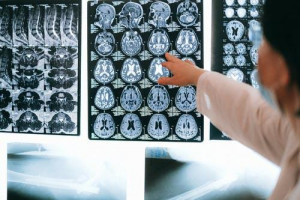 A neurosurgeon studying a brain X-ray